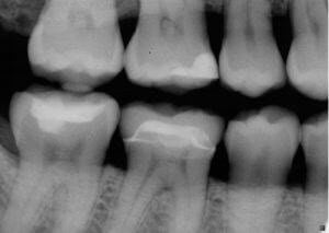 TYPES OF X-RAYS